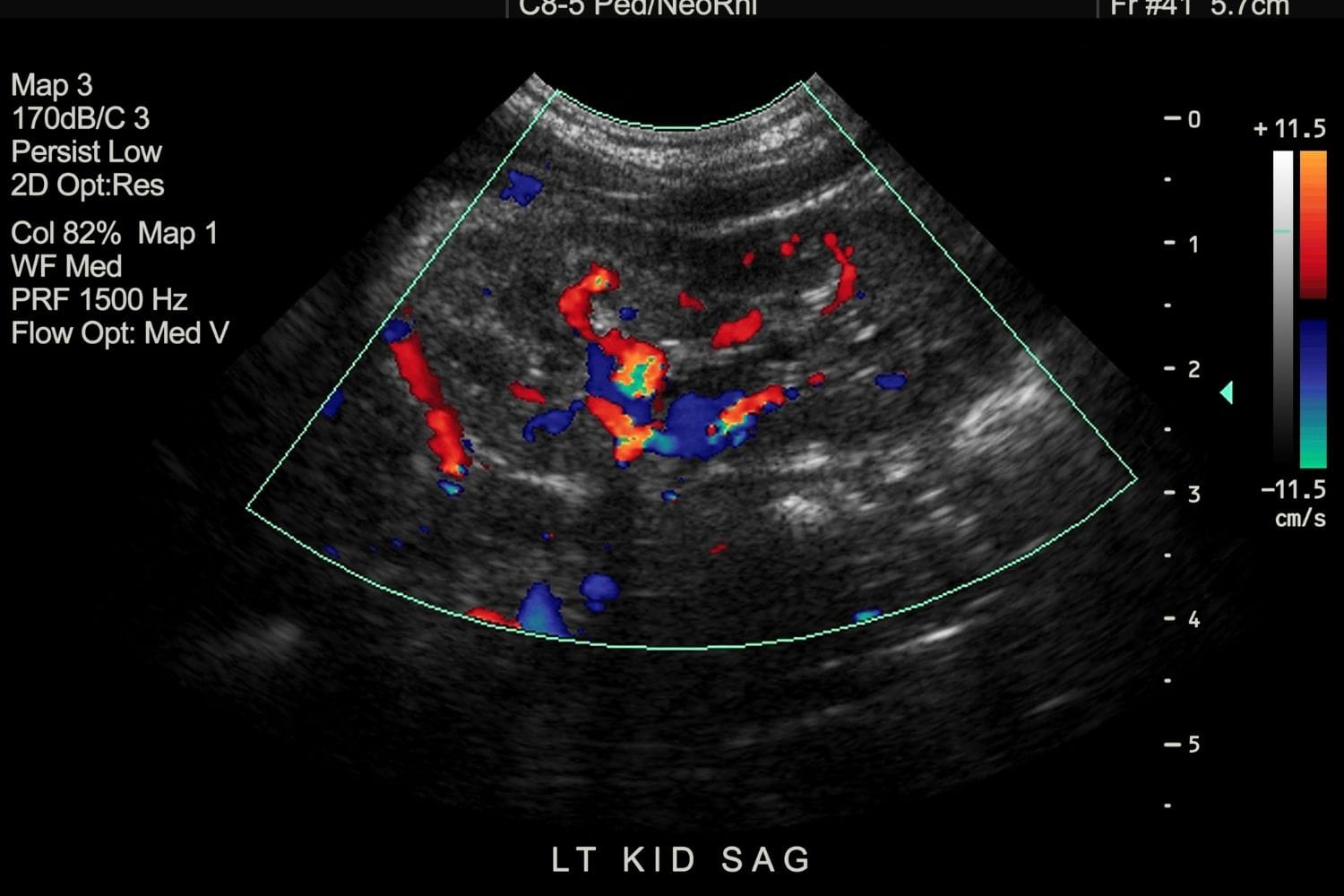 Виды узи. УЗДГ почек. Виды УЗИ В всплески. Ultrasound Mapping Sheet. CRL Ultrasound dating.